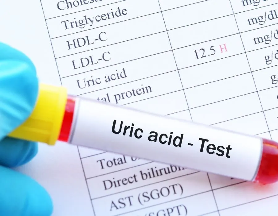 Kiểm soát axit uric hiệu quả Kiem soat axit uric