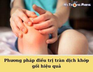 Phuong Phap Dieu Tri Tran Dich Khop Goi Hieu Qua