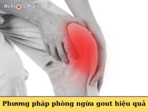 Phuong Phap Ngua Gout