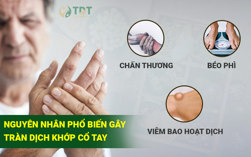 Nguyen Nhan Gay Tran Dich Khop Co Tay