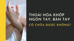 Thoai Hoa Khop Ngon Co Tay